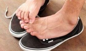 Itching as a cause of fungus