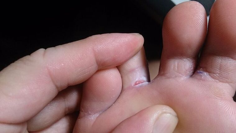 Mushroom between the fingers