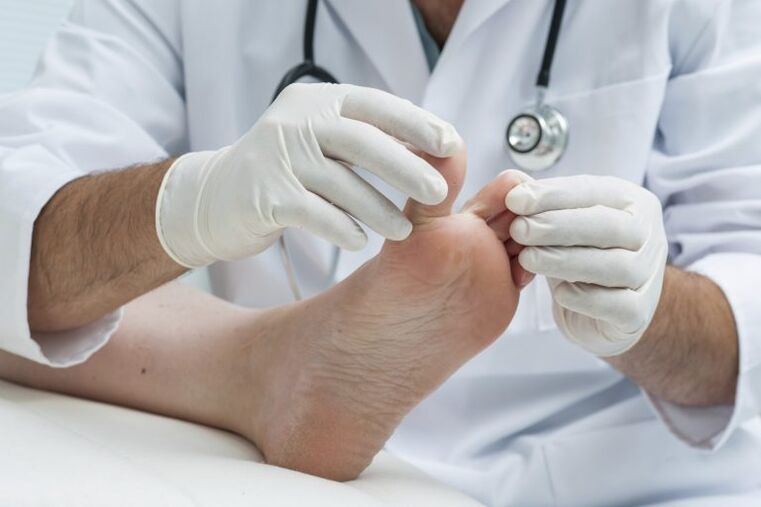 The doctor's examination by the presence of mycosis