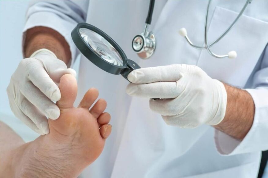 doctor examines nails for fungus