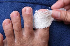 A sick nail