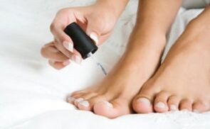 Treatment with varnish