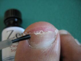 Varnish application